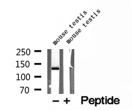 NASP Antibody - Western blot analysis of extracts of mouse testis tissue using NASP antibody.