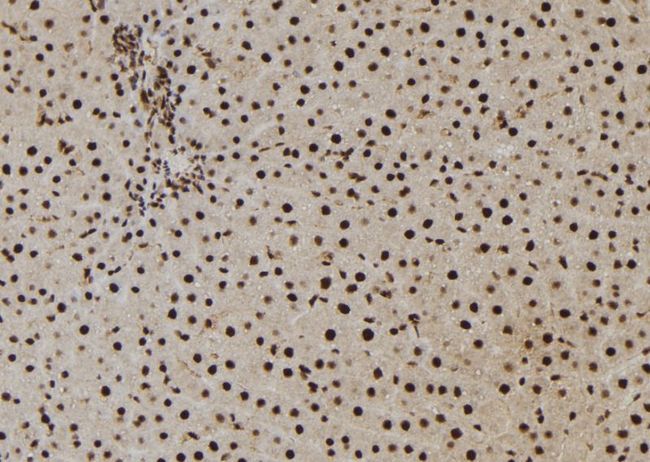 NASP Antibody - 1:100 staining rat liver tissue by IHC-P. The sample was formaldehyde fixed and a heat mediated antigen retrieval step in citrate buffer was performed. The sample was then blocked and incubated with the antibody for 1.5 hours at 22°C. An HRP conjugated goat anti-rabbit antibody was used as the secondary.