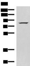 NASP Antibody - Western blot analysis of HepG2 cell lysate  using NASP Polyclonal Antibody at dilution of 1:800