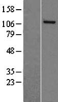 NASP Protein - Western validation with an anti-DDK antibody * L: Control HEK293 lysate R: Over-expression lysate