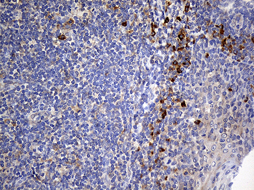 NAT1 / AAC1 Antibody - Immunohistochemical staining of paraffin-embedded Human tonsil within the normal limits using anti-NAT1 mouse monoclonal antibody. (Heat-induced epitope retrieval by 1mM EDTA in 10mM Tris buffer. (pH8.5) at 120°C for 3 min. (1:500)