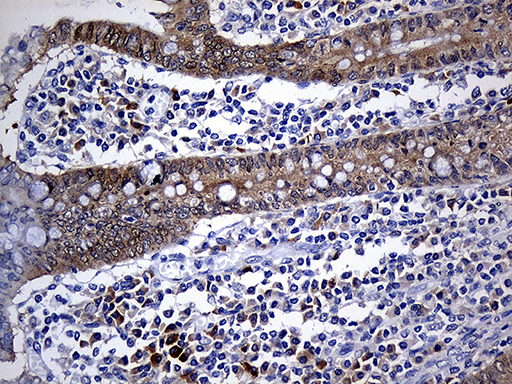 NAT1 / AAC1 Antibody - Immunohistochemical staining of paraffin-embedded Human appendix tissue within the normal limits using anti-NAT1 mouse monoclonal antibody. (Heat-induced epitope retrieval by 1mM EDTA in 10mM Tris buffer. (pH8.5) at 120°C for 3 min. (1:500)