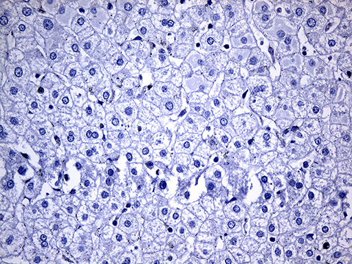 NAT1 / AAC1 Antibody - Immunohistochemical staining of paraffin-embedded Human liver tissue within the normal limits using anti-NAT1 mouse monoclonal antibody.This figure shows negative staining. (Heat-induced epitope retrieval by 1mM EDTA in 10mM Tris buffer. (pH8.5) at 120°C for 3 min. (1:500)