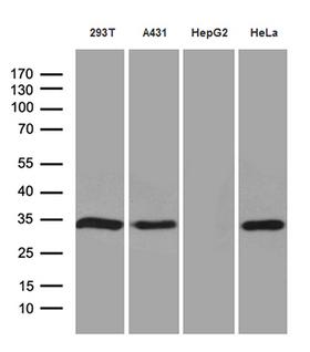 NAT1 / AAC1 Antibody - Western blot analysis of extracts. (35ug) from 4 different cell lines by using anti-NAT1 monoclonal antibody. (1:500)