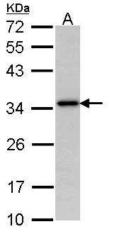 NAT1 / AAC1 Antibody - Sample (30 ug of whole cell lysate). A: Hela. 12% SDS PAGE. NAT1 antibody diluted at 1:1000. 