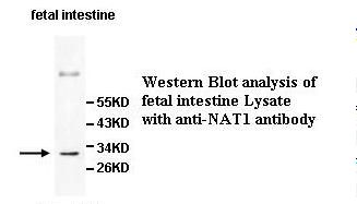 NAT1 / AAC1 Antibody