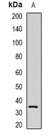 NAT1 / AAC1 Antibody - Western blot analysis of NAT1 expression in U937 (A) whole cell lysates.