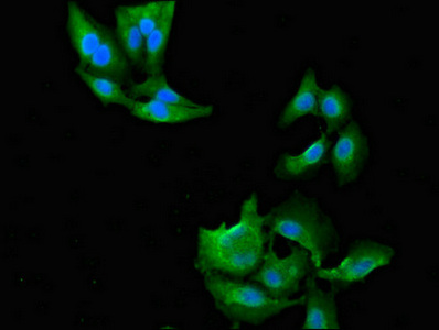 NAT1 / AAC1 Antibody - Immunofluorescent analysis of Hela cells diluted at 1:100 and Alexa Fluor 488-congugated AffiniPure Goat Anti-Rabbit IgG(H+L)