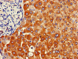 NAT1 / AAC1 Antibody - Immunohistochemistry of paraffin-embedded human liver tissue at dilution of 1:100