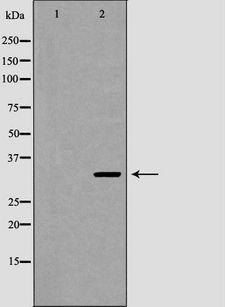NAT1 / AAC1 Antibody - Western blot analysis of extracts of U937 using NAT1 antibody. The lane on the left is treated with the antigen-specific peptide.