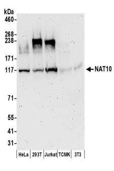 NAT10 Antibody - Detection of Human NAT10 by Western Blot. Samples: Whole cell lysate (50 ug) prepared using NETN buffer from HeLa, 293T, Jurkat, mouse TCMK-1, and mouse NIH3T3 cells. Antibodies: Affinity purified rabbit anti-NAT10 antibody used for WB at 0.04 ug/ml. Detection: Chemiluminescence with an exposure time of 3 minutes.