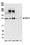 NAT10 Antibody - Detection of Human NAT10 by Western Blot. Samples: Whole cell lysate (50 ug) prepared using NETN buffer from HeLa, 293T, Jurkat, mouse TCMK-1, and mouse NIH3T3 cells. Antibodies: Affinity purified rabbit anti-NAT10 antibody used for WB at 0.04 ug/ml. Detection: Chemiluminescence with an exposure time of 3 minutes.