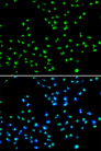 NAT10 Antibody - Immunofluorescence analysis of MCF7 cells.