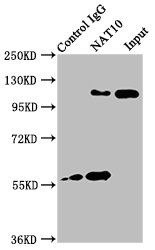 NAT10 Antibody - Immunoprecipitating NAT10 in Hela whole cell lysate Lane 1: Rabbit control IgG instead of NAT10 Antibody in Hela whole cell lysate.For western blotting, a HRP-conjugated Protein G antibody was used as the secondary antibody (1/2000) Lane 2: NAT10 Antibody (6µg) + Hela whole cell lysate (1mg) Lane 3: Hela whole cell lysate (20µg)