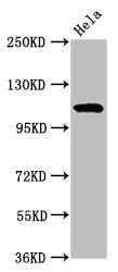 NAT10 Antibody - Western Blot Positive WB detected in: Hela whole cell lysate All lanes:NAT10 antibody at 7µg/ml Secondary Goat polyclonal to rabbit IgG at 1/50000 dilution Predicted band size: 116, 108 kDa Observed band size: 116 kDa