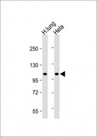 NAT10 Antibody - All lanes: Anti-NAT10 Antibody (N-Term) at 1:2000 dilution Lane 1: Human lung lysate Lane 2: Hela whole cell lysate Lysates/proteins at 20 µg per lane. Secondary Goat Anti-Rabbit IgG, (H+L), Peroxidase conjugated at 1/10000 dilution. Predicted band size: 116 kDa Blocking/Dilution buffer: 5% NFDM/TBST.
