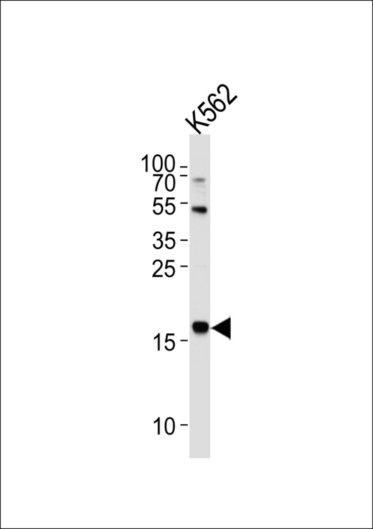 NAT14 Antibody - Western blot of lysate from K562 cell line, using NAT14 Antibody. Antibody was diluted at 1:1000 at each lane. A goat anti-rabbit IgG H&L (HRP) at 1:5000 dilution was used as the secondary antibody. Lysate at 35ug per lane.