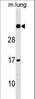 NAT15 Antibody - NAT15 Antibody western blot of mouse lung tissue lysates (35 ug/lane). The NAT15 Antibody detected the NAT15 protein (arrow).