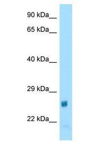 NAT15 Antibody - NAT15 antibody Western Blot of Rat Heart. Antibody dilution: 1 ug/ml.  This image was taken for the unconjugated form of this product. Other forms have not been tested.