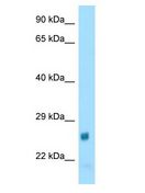 NAT15 Antibody - NAT15 antibody Western Blot of Rat Heart. Antibody dilution: 1 ug/ml.  This image was taken for the unconjugated form of this product. Other forms have not been tested.