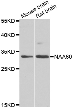 NAT15 Antibody - Western blot analysis of extracts of various cell lines.
