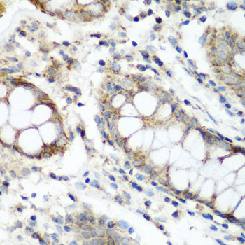 NAT15 Antibody - Immunohistochemistry of paraffin-embedded human colon tissue.