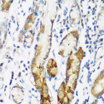 NAT15 Antibody - Immunohistochemistry of paraffin-embedded human gastric tissue.