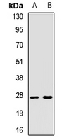 NAT15 Antibody