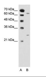 NAT2 Antibody - A: Marker, B: Jurkat Cell Lysate.  This image was taken for the unconjugated form of this product. Other forms have not been tested.