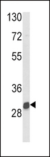 NAT2 Antibody - Western blot of NAT2 Antibody in mouse kidney tissue lysates (35 ug/lane). NAT2 (arrow) was detected using the purified antibody.