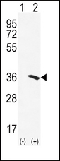 NAT2 Antibody - Western blot of NAT2 (arrow) using rabbit polyclonal NAT2 Antibody. 293 cell lysates (2 ug/lane) either nontransfected (Lane 1) or transiently transfected (Lane 2) with the NAT2 gene.