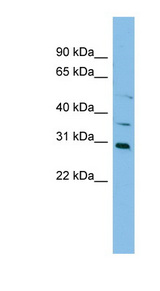 NAT2 Antibody - NAT2 antibody Western blot of HepG2 cell lysate. This image was taken for the unconjugated form of this product. Other forms have not been tested.