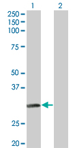 NAT2 Antibody - Western Blot analysis of NAT2 expression in transfected 293T cell line by NAT2 monoclonal antibody (M01), clone 3B5.Lane 1: NAT2 transfected lysate(33.5 KDa).Lane 2: Non-transfected lysate.