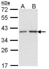 NAT2 Antibody - Sample (30 ug of whole cell lysate). A: A431. B: H1299. 12% SDS PAGE. NAT2 antibody diluted at 1:1000. 