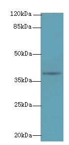NAT2 Antibody - Western blot. All lanes: NAT2 antibody at 6 ug/ml+ Mouse brain tissue Goat polyclonal to rabbit at 1:10000 dilution. Predicted band size: 34 kDa. Observed band size: 34 kDa.