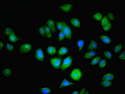 NAT2 Antibody - Immunofluorescent analysis of A549 cells using NAT2 Antibody at dilution of 1:100 and Alexa Fluor 488-congugated AffiniPure Goat Anti-Rabbit IgG(H+L)