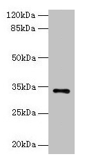 NAT2 Antibody - Western blot All lanes: NAT2 antibody at 6µg/ml + Mouse brain tissue Secondary Goat polyclonal to rabbit IgG at 1/10000 dilution Predicted band size: 34 kDa Observed band size: 34 kDa