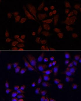 NAT2 Antibody - Immunofluorescence analysis of 293T cells using NAT2 antibody at dilution of 1:100 (40x lens). Blue: DAPI for nuclear staining.