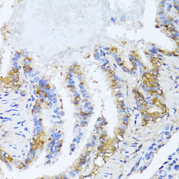 NAT2 Antibody - Immunohistochemistry of paraffin-embedded rat lung using NAT2 antibody at dilution of 1:100 (40x lens).