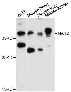 NAT2 Antibody - Western blot analysis of extracts of various cell lines, using NAT2 antibody at 1:3000 dilution. The secondary antibody used was an HRP Goat Anti-Rabbit IgG (H+L) at 1:10000 dilution. Lysates were loaded 25ug per lane and 3% nonfat dry milk in TBST was used for blocking. An ECL Kit was used for detection and the exposure time was 30s.
