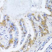 NAT2 Antibody - Immunohistochemistry of paraffin-embedded Rat lung using NAT2 Polyclonal Antibody at dilution of 1:100 (40x lens).
