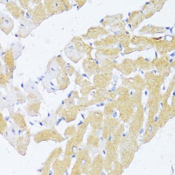 NAT2 Antibody - Immunohistochemistry of paraffin-embedded Rat heart using NAT2 Polyclonal Antibody at dilution of 1:100 (40x lens).