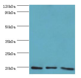 NAT5 / NAA20 Antibody - Western blot. All lanes: NAA20 antibody at 10 ug/ml. Lane 1: HeLa whole cell lysate. Lane 2: Rat brain tissue. Lane 3: 293T whole cell lysate. Secondary antibody: Goat polyclonal to rabbit at 1:10000 dilution. Predicted band size: 20 kDa. Observed band size: 20 kDa.