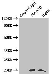 NAT5 / NAA20 Antibody - Immunoprecipitating NAA20 in Hela whole cell lysate Lane 1: Rabbit monoclonal IgG (1µg) instead of NAA20 Antibody in Hela whole cell lysate.For western blotting, a HRP-conjugated anti-rabbit IgG, specific to the non-reduced form of IgG was used as the Secondary antibody (1/50000) Lane 2: NAA20 Antibody (4µg) + Hela whole cell lysate (500µg) Lane 3: Hela whole cell lysate (20µg)