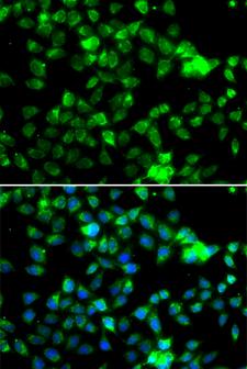 NAT5 / NAA20 Antibody - Immunofluorescence analysis of A549 cell using NAA20 antibody. Blue: DAPI for nuclear staining.