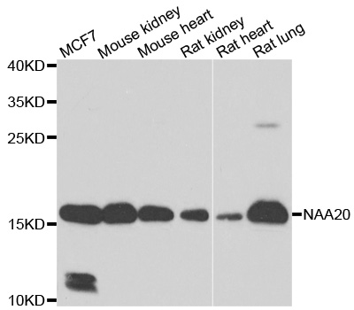 NAT5 / NAA20 Antibody - Western blot analysis of extracts of various cell lines.