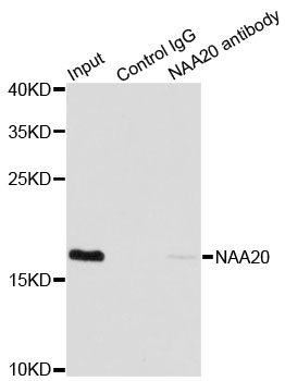 NAT5 / NAA20 Antibody - Immunoprecipitation analysis of 200ug extracts of MCF7 cells.