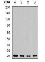 NAT5 / NAA20 Antibody - Western blot analysis of NAT5 expression in MCF7 (A); mouse kidney (B); mouse heart (C); rat lung (D) whole cell lysates.