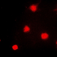 NAT5 / NAA20 Antibody - Immunofluorescent analysis of NAT5 staining in A549 cells. Formalin-fixed cells were permeabilized with 0.1% Triton X-100 in TBS for 5-10 minutes and blocked with 3% BSA-PBS for 30 minutes at room temperature. Cells were probed with the primary antibody in 3% BSA-PBS and incubated overnight at 4 deg C in a humidified chamber. Cells were washed with PBST and incubated with a DyLight 594-conjugated secondary antibody (red) in PBS at room temperature in the dark.