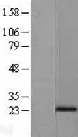 NAT5 / NAA20 Protein - Western validation with an anti-DDK antibody * L: Control HEK293 lysate R: Over-expression lysate